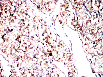 ACOD1 Antibody