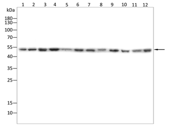 ACOD1 Antibody
