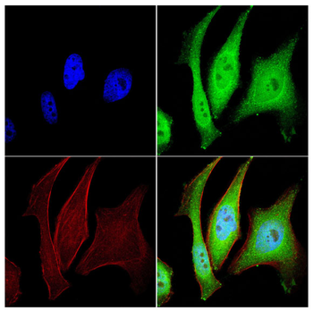 KRT12 Antibody