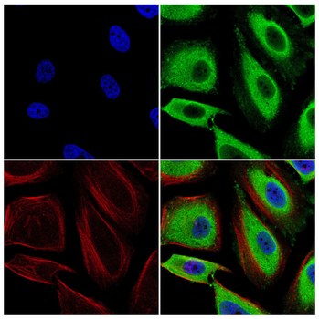 SLC40A1 Antibody