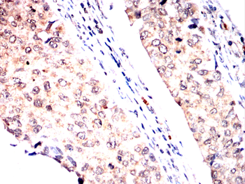 PSAT1 Antibody