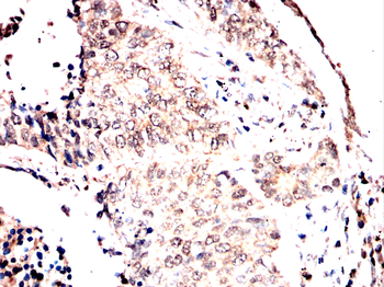 PSAT1 Antibody