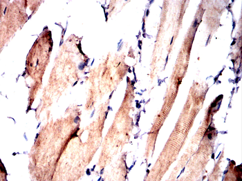 PSAT1 Antibody