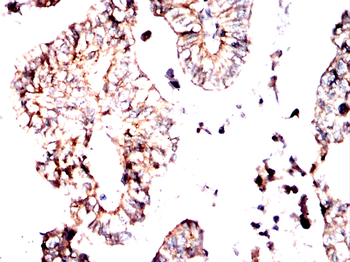 PSAT1 Antibody