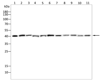 PSAT1 Antibody