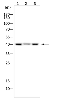 PSAT1 Antibody