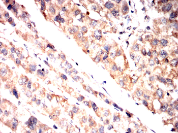 PSAT1 Antibody