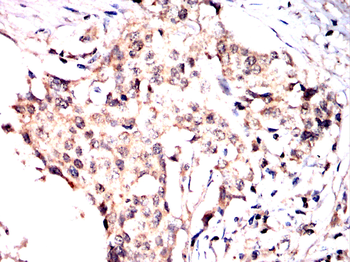 PSAT1 Antibody