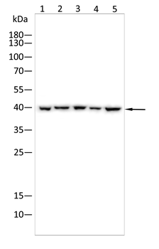 PSAT1 Antibody