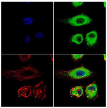 MOB1B/MOB1A Antibody