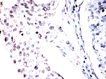 MOB1B/MOB1A Antibody
