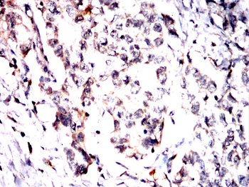 MOB1B/MOB1A Antibody