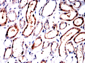 MOB1B/MOB1A Antibody