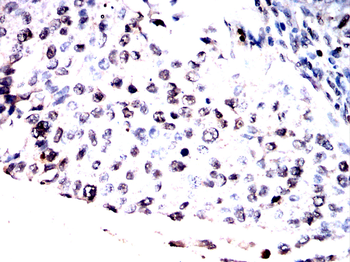 BMAL2 Antibody