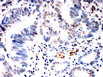 BMAL2 Antibody