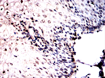 BMAL2 Antibody