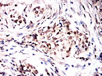 BMAL2 Antibody
