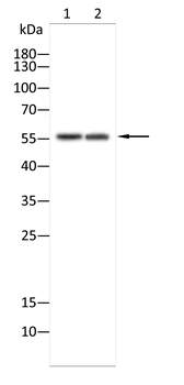 CAMK2D Antibody