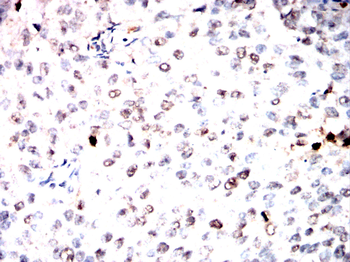 RBFOX1 Antibody