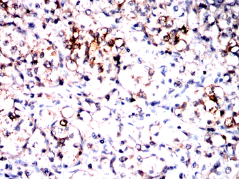RBFOX1 Antibody