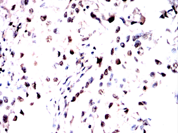 CSNK1A1/CSNK1A1L Antibody