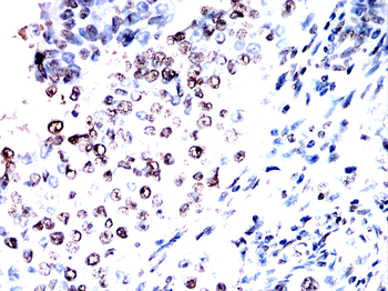 CSNK1A1/CSNK1A1L Antibody