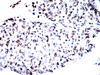 CSNK1A1/CSNK1A1L Antibody