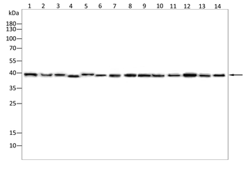 CSNK1A1/CSNK1A1L Antibody