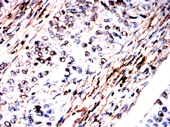 ACTA1 Antibody