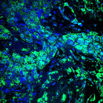ACTA1 Antibody