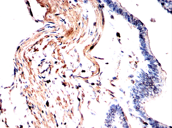 ACTA1 Antibody