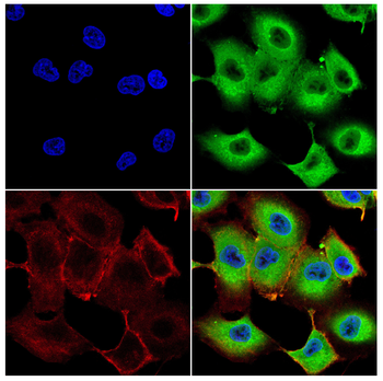 Gpx3 Antibody