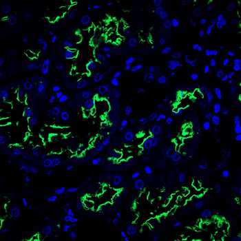 Gpx3 Antibody