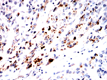 Gpx3 Antibody