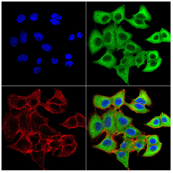 SOCS1 Antibody