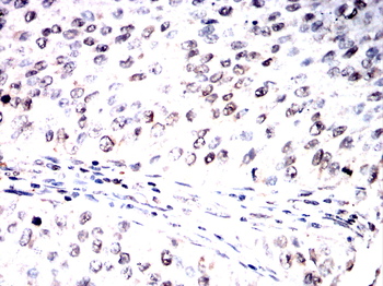 SOCS1 Antibody