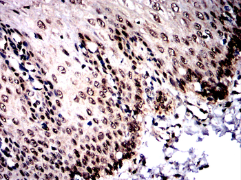 SOCS1 Antibody