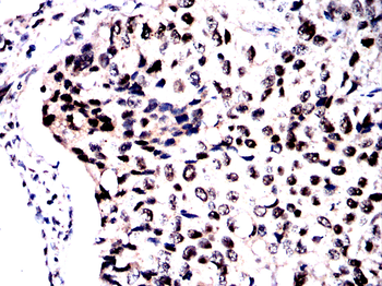 SOCS1 Antibody