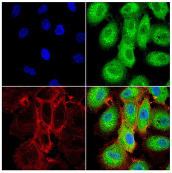 HLA-A Antibody