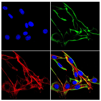 HLA-A Antibody