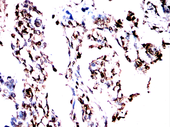 TRIM25 Antibody