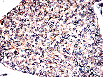 TRIM25 Antibody