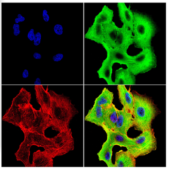 ATP6V1A Antibody