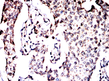ATP6V1A Antibody