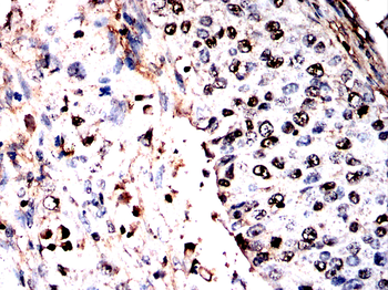 ATP6V1A Antibody