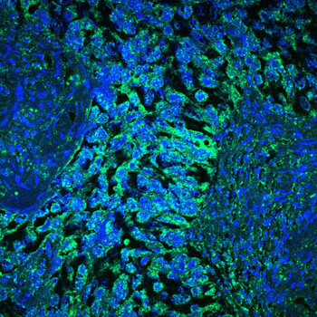 ATP6V1A Antibody