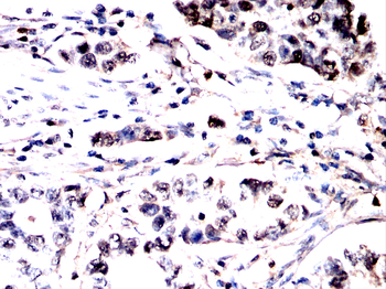 ATP6V1A Antibody