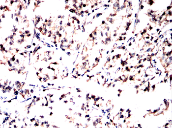 ATP6V1A Antibody