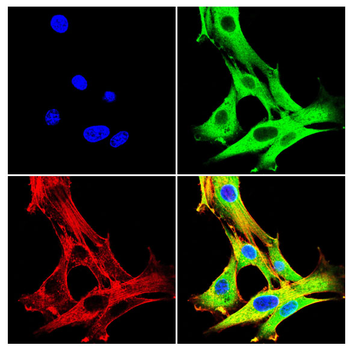 ATP6V1A Antibody