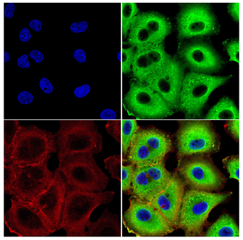 STOM Antibody